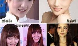 西安整容爆料案件最新情况,真相逐步浮出水面